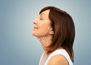 profile of senior woman with face lifting arrows