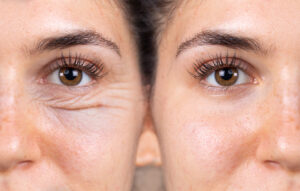 A young woman shows the before and after results of successful b